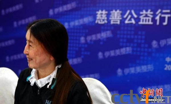 女子分娩后皮肤松弛一夜变老 全球仅有不足10例（组图）