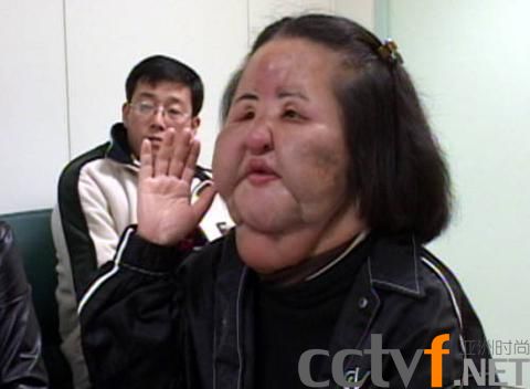电风扇大妈美女疯狂整容上瘾酿悲剧