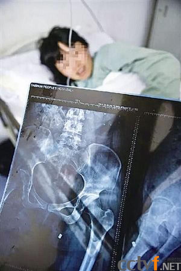 Ų̊ǹ е20(ͼ)