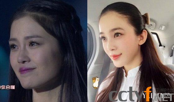 赵韩樱子整容前后